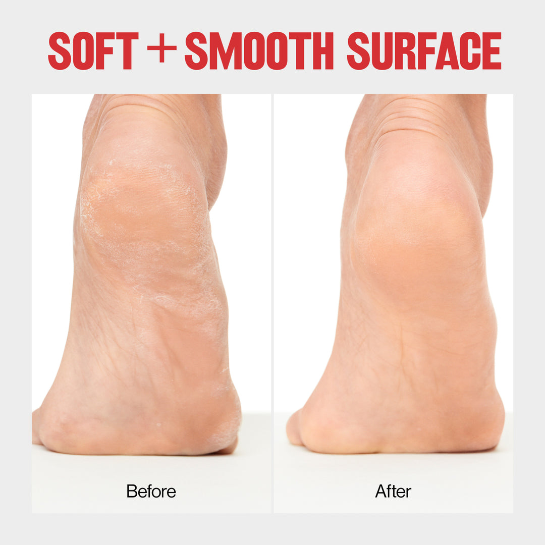 Wet/Dry Foot File - Pedicure Tool - before and after