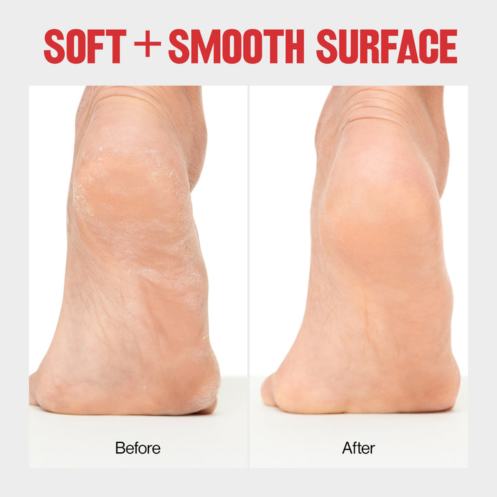 Wet/Dry Foot File - Pedicure Tool - before and after